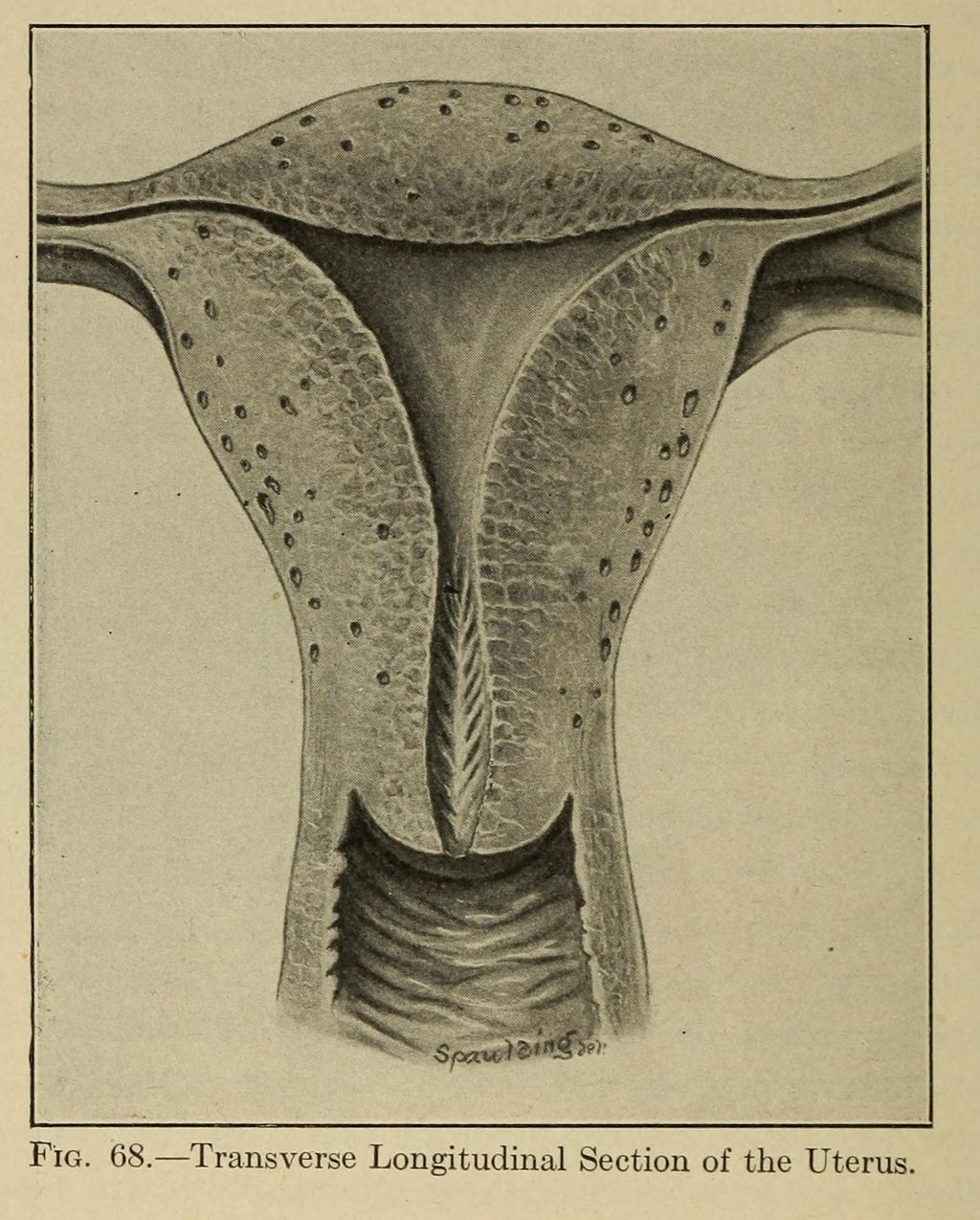 Burrage, Walter L. Gynecological Diagnosis. New York, London, D. Appleton and Company, 1910. informed consent